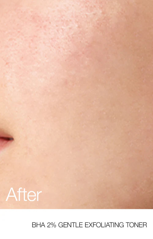 Anua Bha 2% Gentle Exfoliating Toner