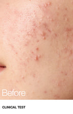 Anua Bha 2% Gentle Exfoliating Toner
