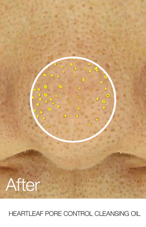 Anua Heartleaf Pore Control Cleansing Oil