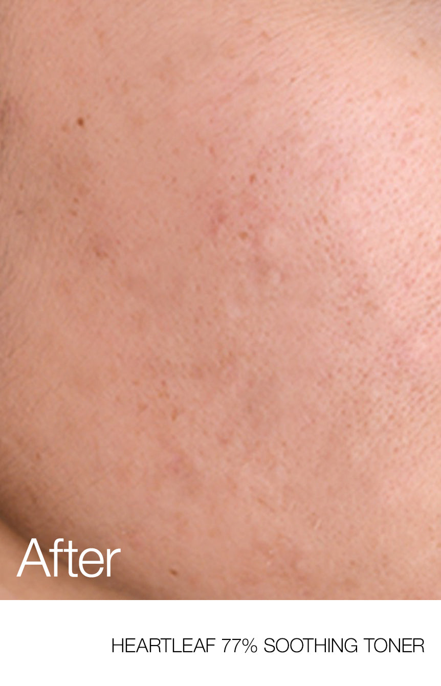 Anua Heartleaf 77 Soothing Toner