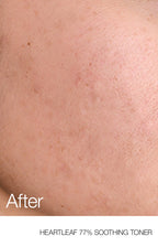 Anua Heartleaf 77 Soothing Toner