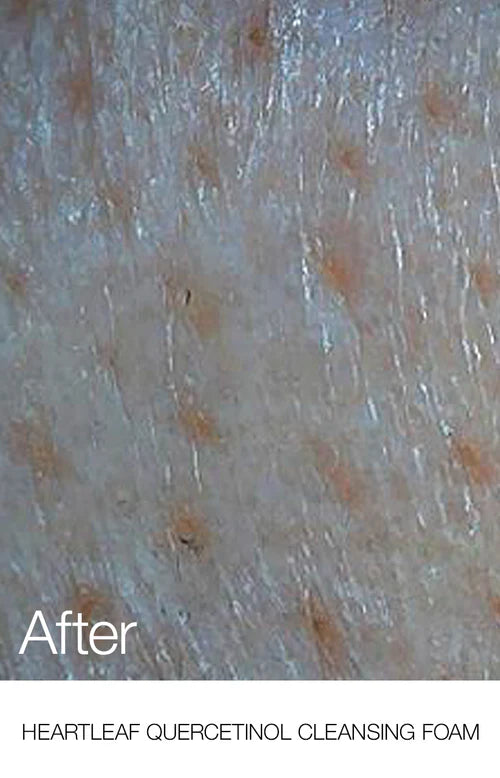Anua Heartleaf Quercetinol Pore Deep Cleansing Foam