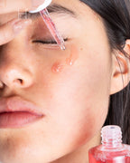 Anua Niacinamide 10 Txa 4 Serum