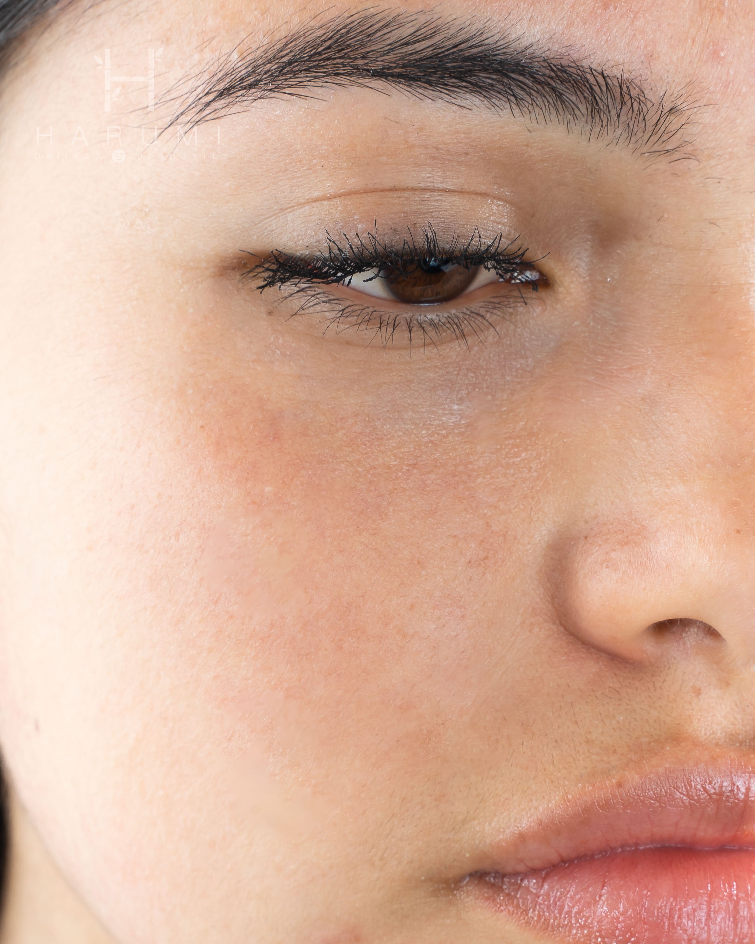 Tratamiento localizado facial en barra de Maxclinic - Maxclinic Cassage ...